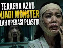 Aku Terkena Azab Menjadi Monster Setelah Operasi Plastik