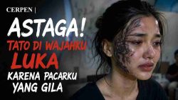 CERPEN | ASTAGA! TATO DI WAJAHKU LUKA KARENA PACARKU YANG GILA 7 CERPEN | ASTAGA! TATO DI WAJAHKU LUKA KARENA PACARKU YANG GILA